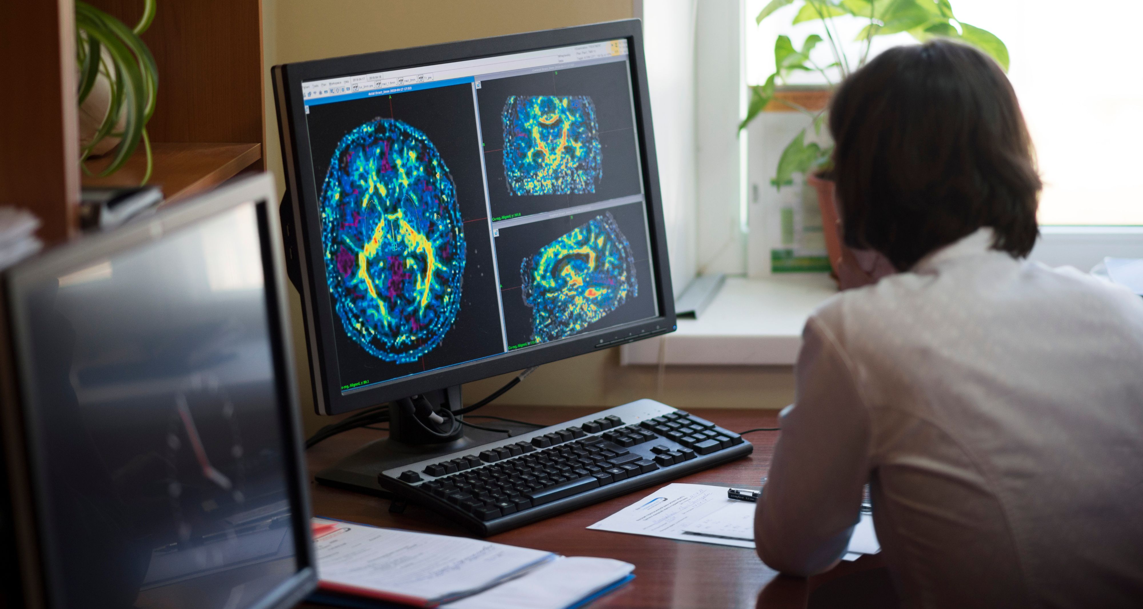 Scientist looks at an image of a brain scan on a computer.