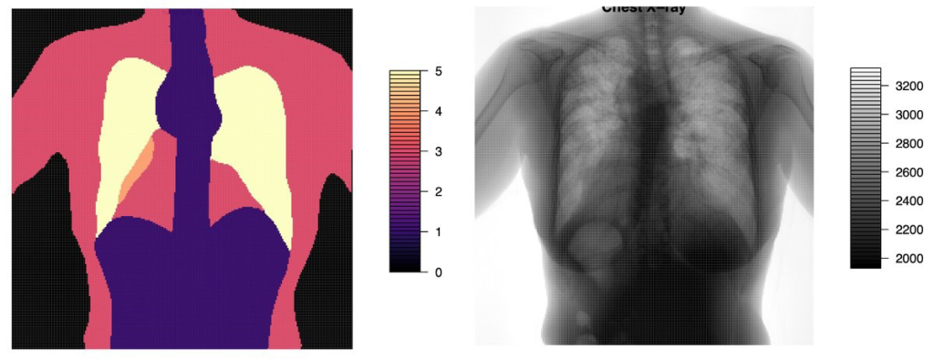 Fig. 1: An example of the Invicro chest X-ray intensity image and corresponding quality map. Invicro’s medical imaging codebase, ANTsR and ANTsRNet, includes a ResNet50 architecture that they used successfully for natural image quality prediction. ML Solutions Lab used Invicro’s X-ray dataset and imaging codebase to explore generalizations from natural image quality CNNs, and for maximizing performance on quality predictions for images from the chest X-ray dataset.