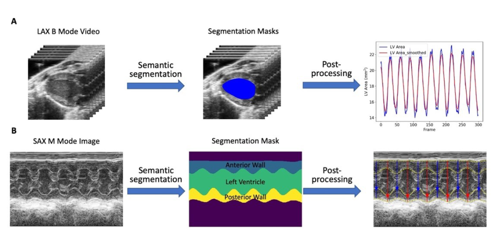 Pfizer’s Echocardiography Analysis Framework Reduces Time by +92 Using