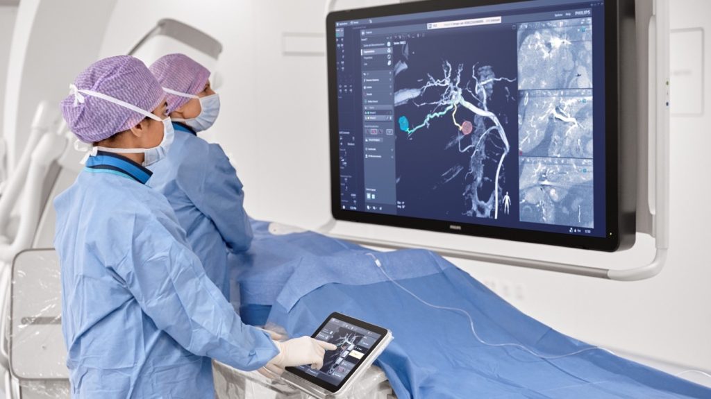 Figure 1 Philips Image Guided Therapy Azurion System