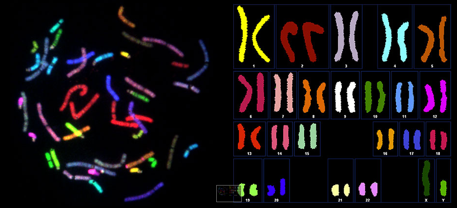  Spectral karyotype analysis / Image courtesy of Human Longevity, Inc.