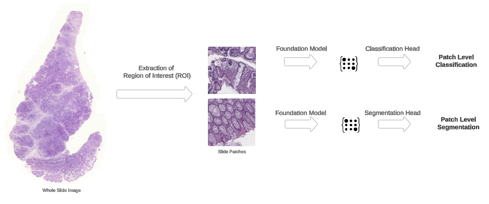 The following diagram illustrates the workflow of patch-level prediction tasks on a WSI